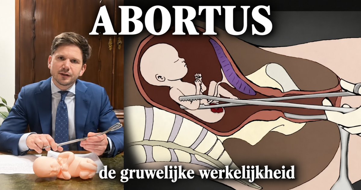 Vandaag is de "Dag van de Veilige Abortus". Een goed moment om weer eens stil te staan bij de gruwelijke waarheid die erachter schuilgaat. Deze video toont de standaard abortusmethode in het tweede trimester. Kijk en oordeel zelf hoe veilig dit is voor het ongeboren kind.
