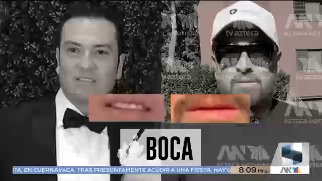 🚨 Amílcar Olán se sometió a una cirugía para rejuvenecerse y se dejó barba y bigote, pero no fue suficiente para no ser reconocido.
