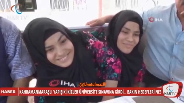 Muhabirin yapışık ikizlere (Siyam ikizleri) o ilginç soruyu soralı tam 7 yıl oldu... 😂