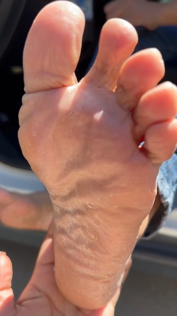 Mom needs her foot cleaner to do their job