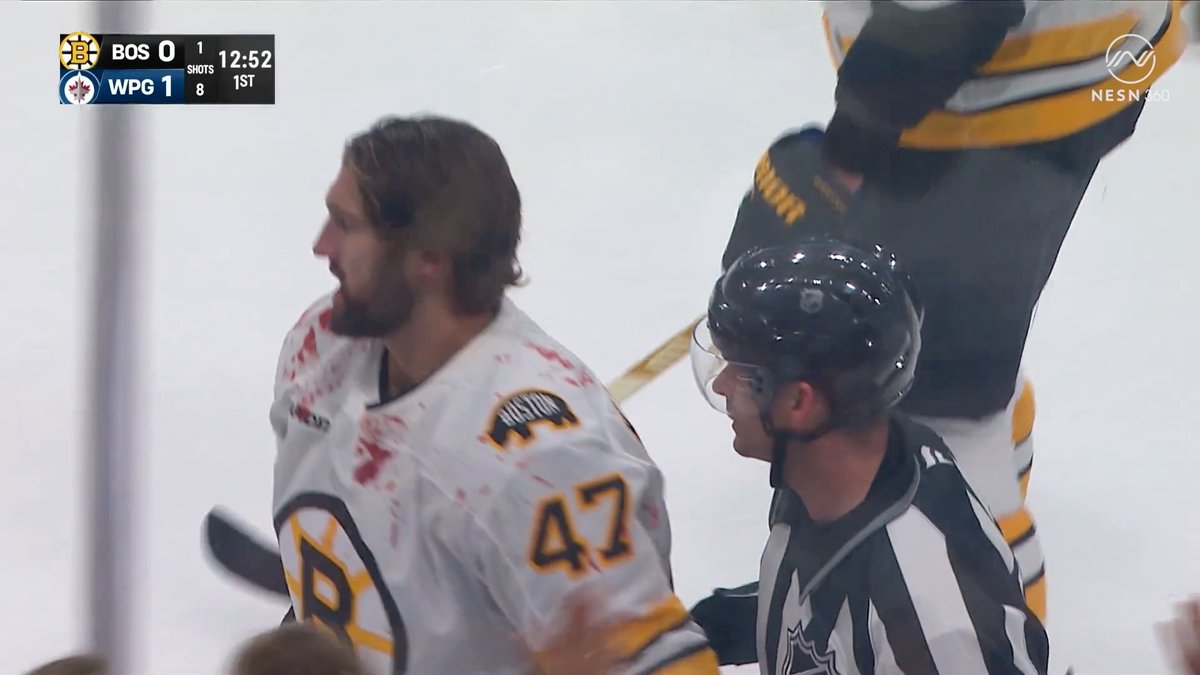 NOW THAT’S AN OLD SCHOOL TILT 🍿🤜