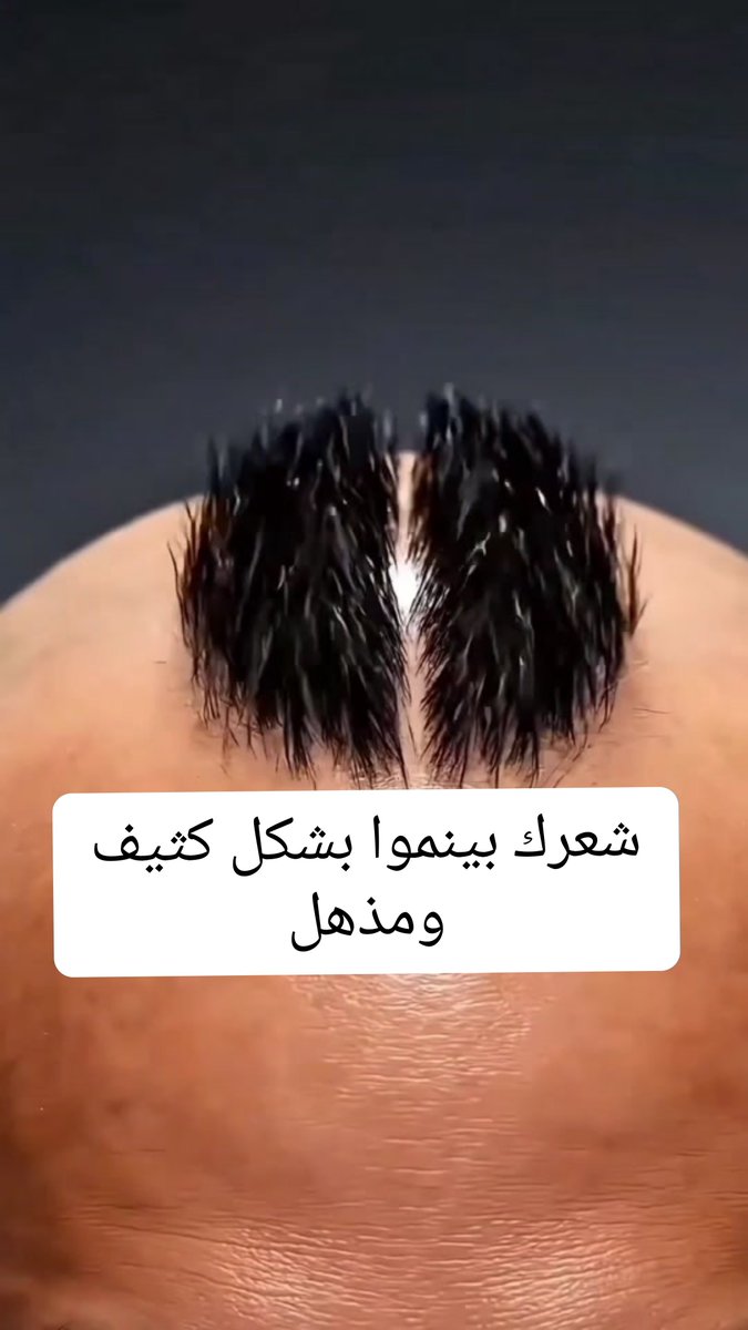للنساء فقط... اذا استخدمتي هذا الخليط بيخلي شعرك ينمو كل يوم أكثر من اللازم