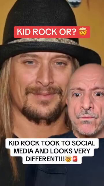What happened to Kid Rock?