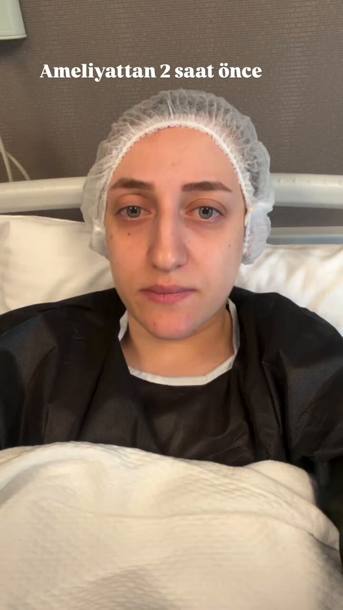 Burun ameliyatı geçiren bir vatandaş, ameliyat sonrası 5 aylık değişimini paylaştı.