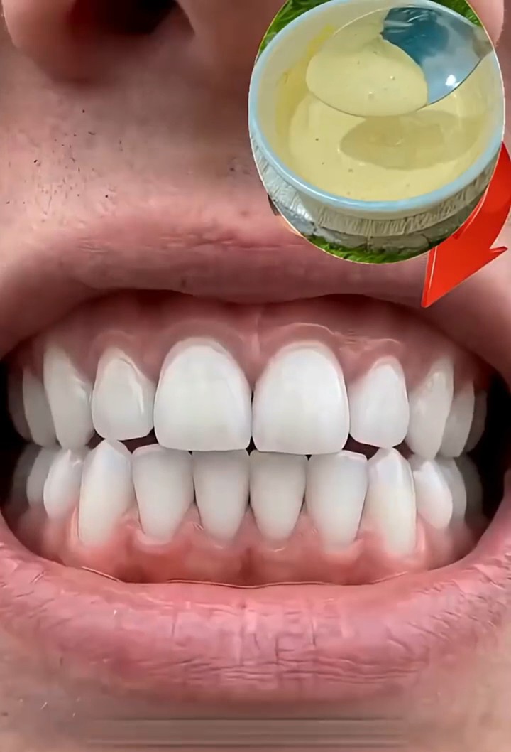 Make your teeth shine again by using this trick.