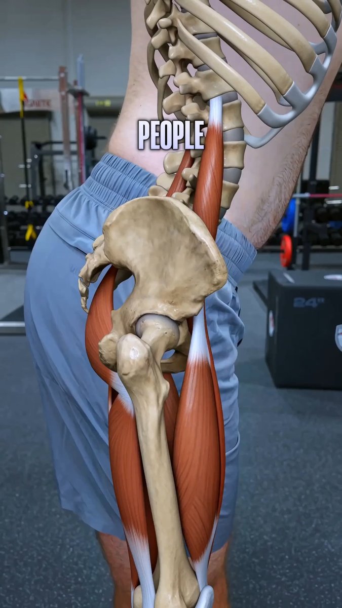 Squeezing your glutes will not fix an anterior pelvic tilt. It locks your pelvis, low back, and hips into one stiff block. The fix is restoring motion between them.