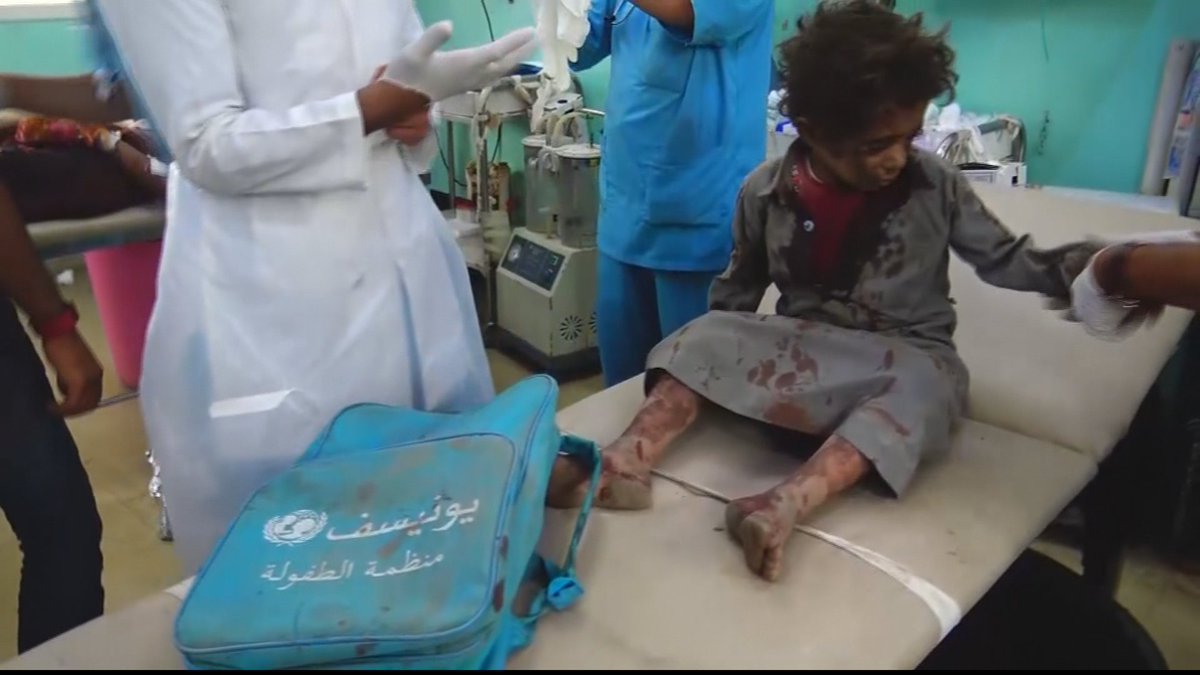 أين كنت أيها العالم الساذج حينما قصفت السعودية حافلة أطفال في ضحيان صعدة؟؟