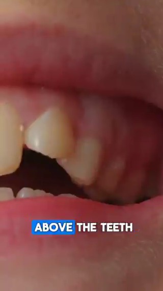 This is how to STOP receding gums! Share this with someone it could help. Dr. Eric Berg, DC, not MD; information only