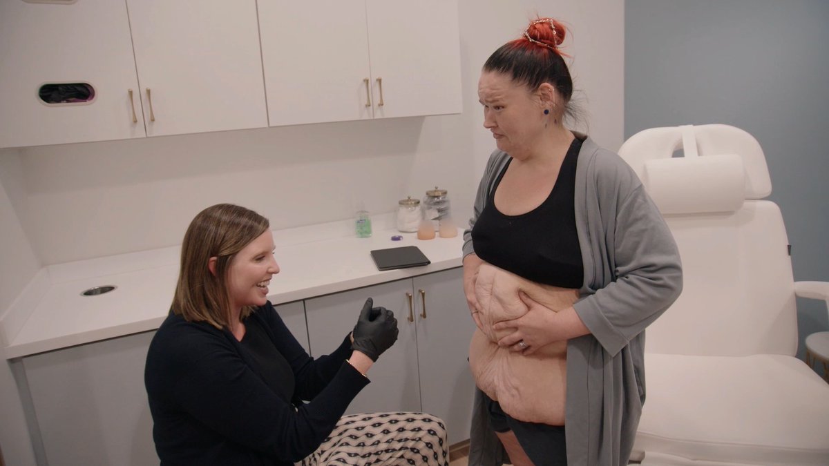 Amy's getting another skin removal consultation on #1000lbSisters, tonight at 9P. 👀