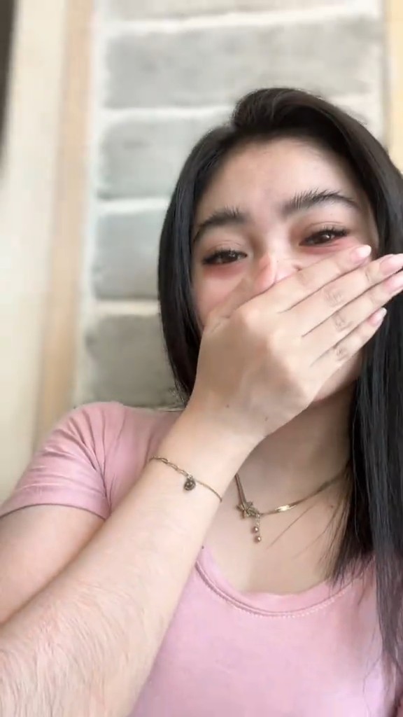 Tolong jelaskan kenapa bisa perempuan punya bulu tangan lebat kek begini? salah makan kah?