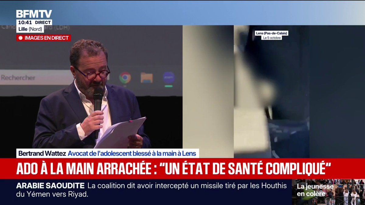 🗨️ "Nous avons été choqués" L'avocat du lycéen amputé à Lens conteste la version des faits du parquet