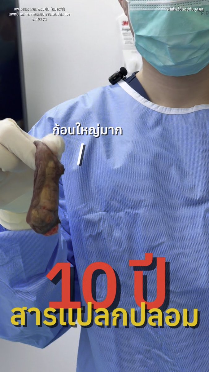 หมอฟรีเอาออกหมดเอาอยู่ทุกสารแปลกปลอม!!! #MasterpieceHospital #menhealthbymasterpiece #โรงพยาบาลมาสเตอร์พีช #ขลิบ #หมอฟรีขยี้ไข่ #หมอฟรีมาสเตอร์พีช #แก้สารแปลกปลอม