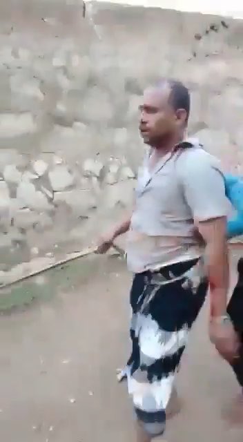 قيادي حوثي يسقط أسيراً بيد ابطال القوات المسلحة و المقاومة في تعز، وقد ظهر في فيديو سابق يهدد و يتوعد أهل #تعز انه يربطهم ويسحلهم بالشوارع.