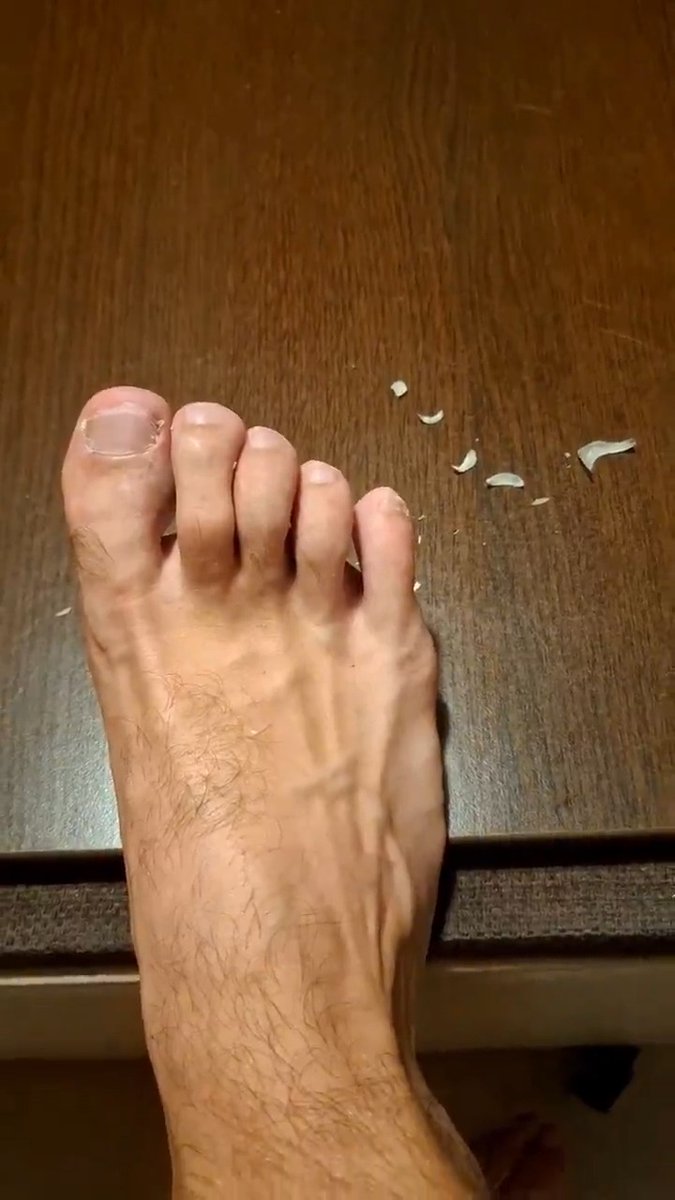 Cutting toenails GONE WRONG 😖 – part 1: right foot massacre 😵💫. Kneel, SEND & watch the wreckage. 💸🦶