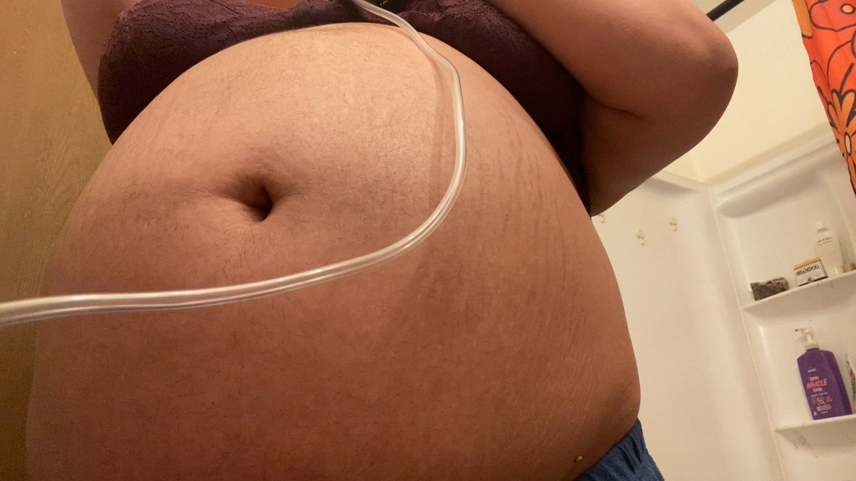 Inflating both during + after drinking 2L cake shake and 1.5L water in about an hour. Now that I have a more powerful pump I’m gonna try for daily inflations 😁🎈💥💥#bellyinflation #fat #fatbelly #pregnant #feedee #feedism #fatbbw #bbw #bigbelly #gettingfat #burps