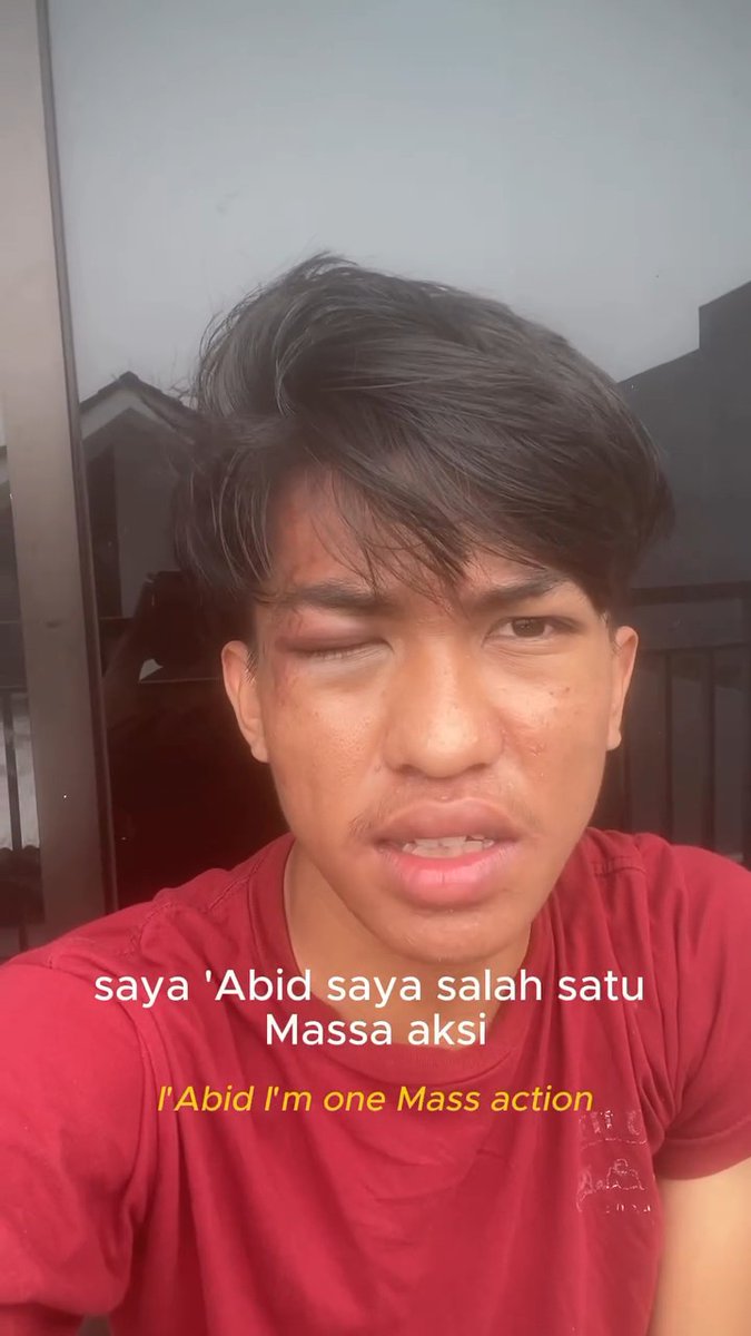 abid, salah satu massa aksi yang mendapat tindakan represif dari aparat kemarin. dia menjelaskan bahwa dia ditarik ke barisan polisi, lalu langsung digebukin, diinjak-injak, dijambak, dipukul, dan ditendang hingga seluruh tubuhnya. abid berhasil lepas, lalu dibawa ke ambulans, berkat bantuan kawan-kawan di sana. meskipun banyak yang ditangkap atau mengalami tindakan represif dari aparat saat aksi kemarin... abid berpesan, jangan sampai isu di dalam tuntutan yang dibawa itu terdegradasi atau terlupakan akibat kelakuan aparat yang represif. speed recovery, abid! #IndonesiaSadar