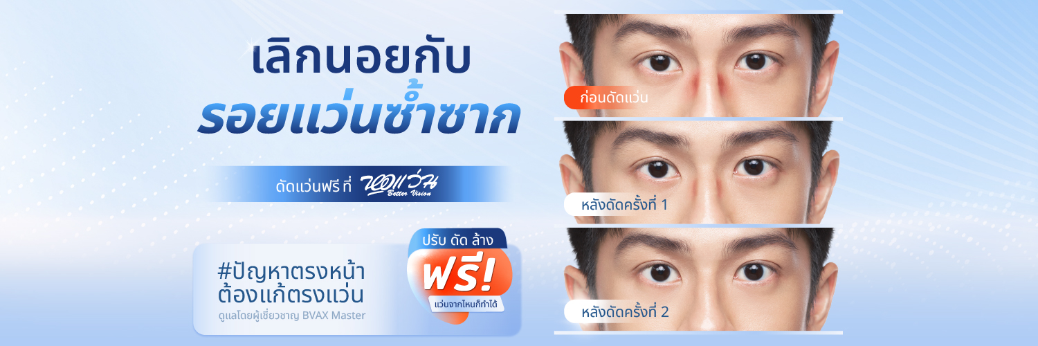 หอแว่น Better Vision's banner