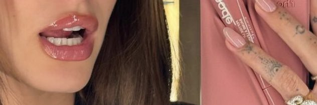 •i•'s banner