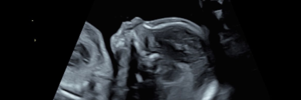 ¹⁹¹³'s banner