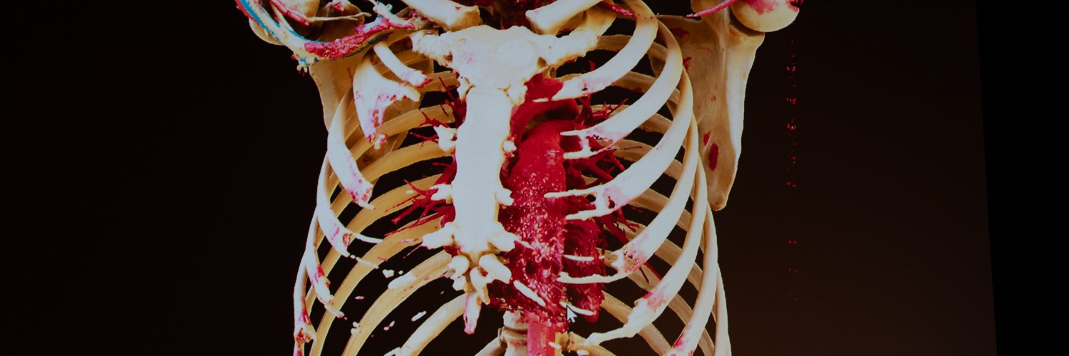 瀬尾 拡史 Hirofumi Seo, MD, PhD's banner