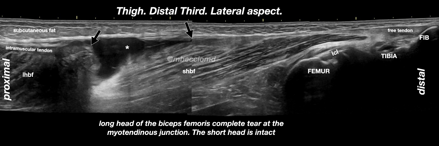 Ultrasound Imaging's banner