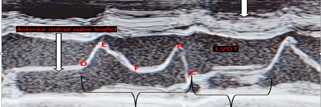 Pulmonary-POCUS's banner