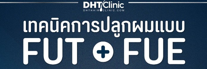 タイ植毛-DHTクリニック・アブソリュートヘアークリニック日本語窓口's banner