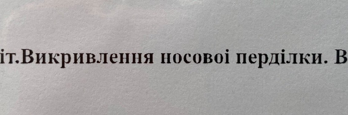 Дениско, 30 рочків's banner