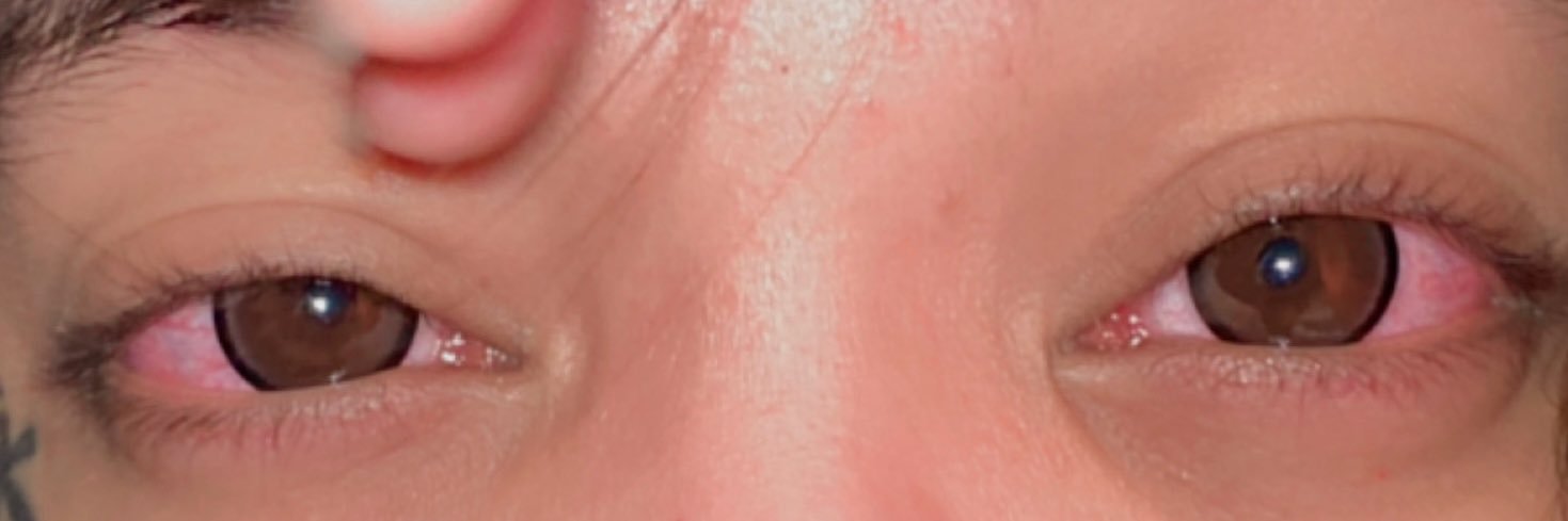 Ａｌｏｄｉｅ's banner