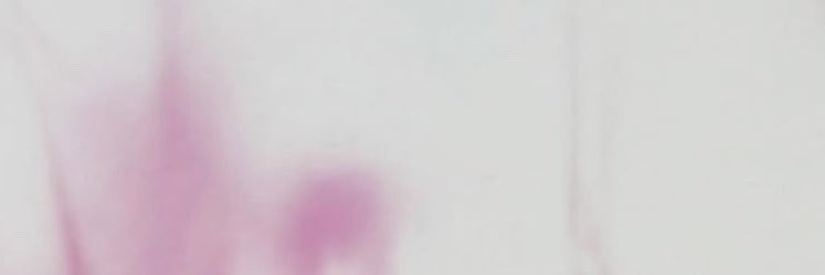 ᴋʏʟᴇ ʀᴏʙʙ🍒's banner