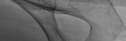AVa's banner