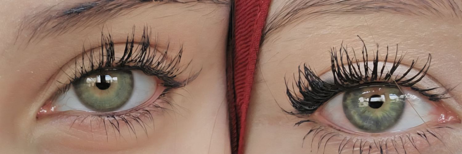 Öznurᥫ᭡'s banner