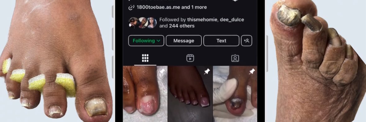 BROWARD | 1800Toebae 💕's banner