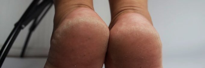 WeLoveFeet🧀💦😱's banner