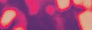 løla ⊬ misses tyler's banner