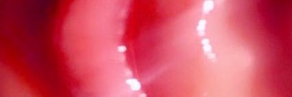 every man weakness aka Kennedy's banner