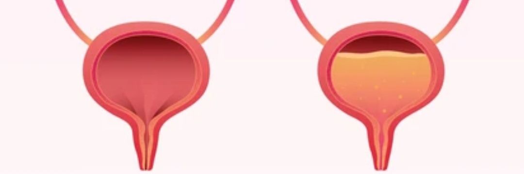 Omorashilovers's banner