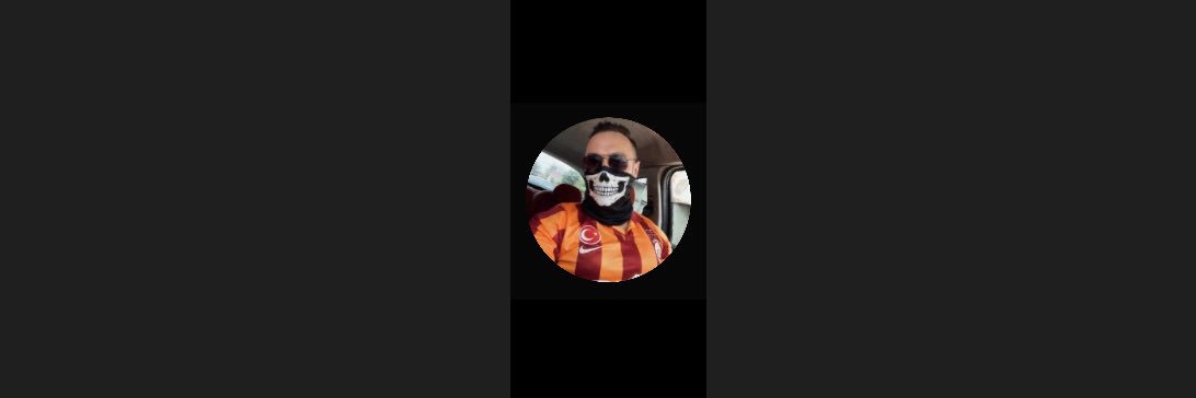 🇹🇷yağız saç kaybı's banner