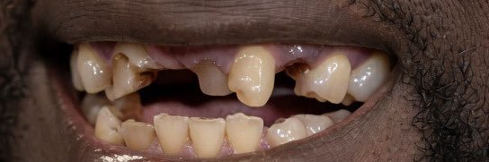 KING DNA TOOTH 👑🦷's banner