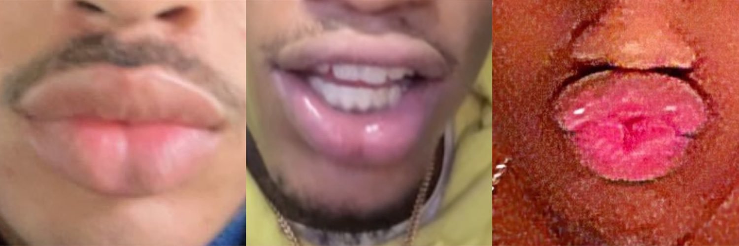 yo lips stank's banner