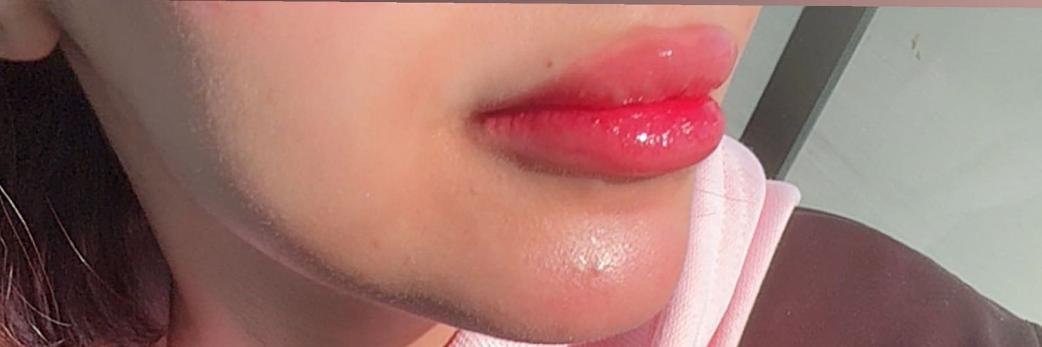 J's banner