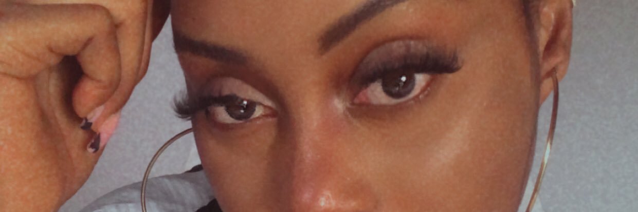 Chance (Traits de beautés sans chirurgie)'s banner
