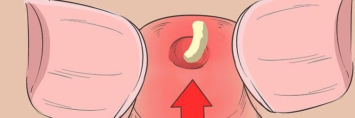 Blackhead & Pimple's banner