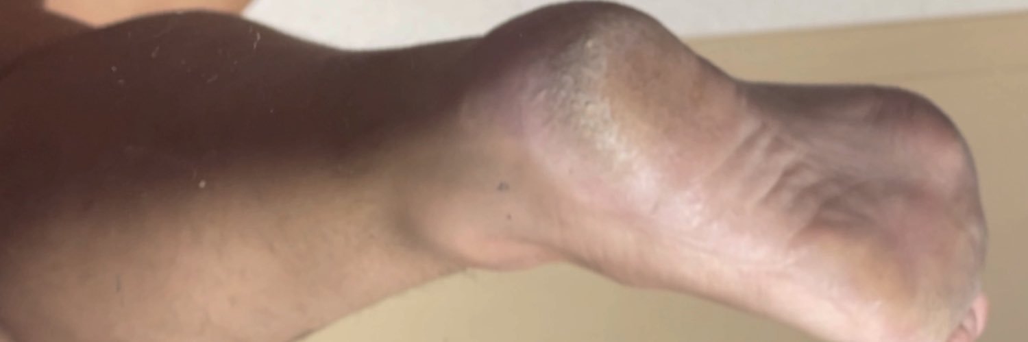 MF🦶's banner