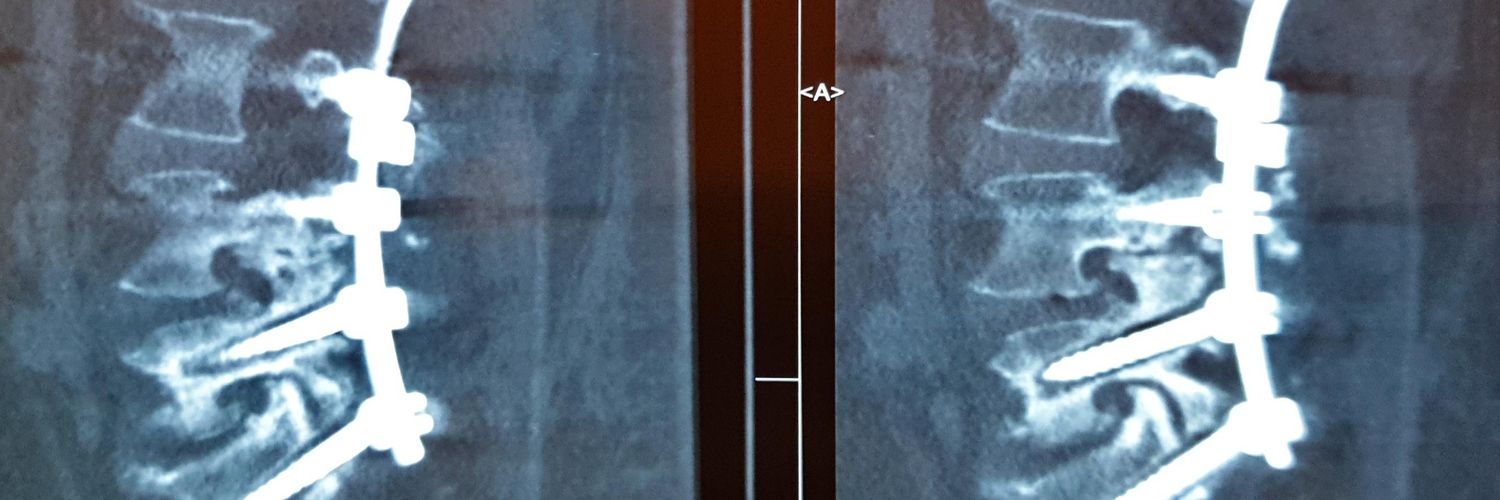 Dr. Spine, مَهدی's banner