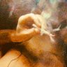 Cloudy Cough Droplets's profile picture