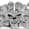 Brain Gremlin ⚡ BTC's profile picture