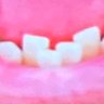 Profilbild von Will Ferrell’s bottom teeth