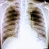 Profilbild von xrays