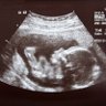 Profilbild von Pitt Fetal Research